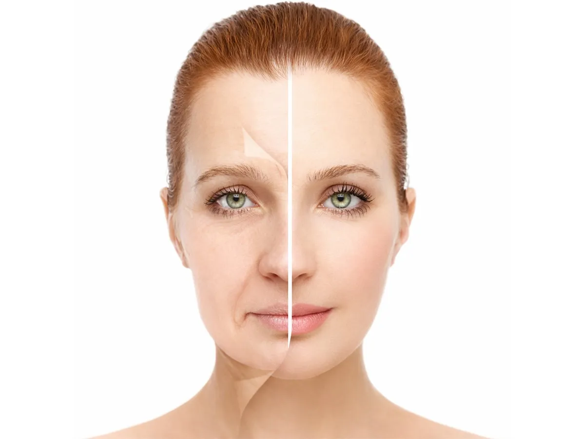 Dolgu uygulaması nedir